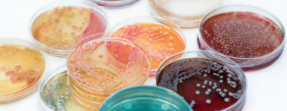 Mikrobiologie - Der andere Laborauftrag 2026